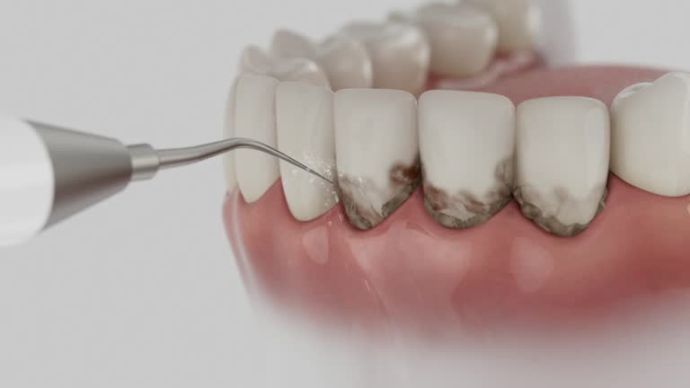 Reliable Dental Implants contractor in Folsom, CA by Smile Center Dentistry